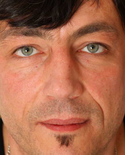 Dieter Von Stein