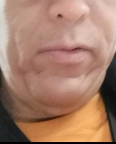 Mang Kanor