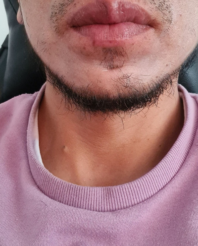 Rico